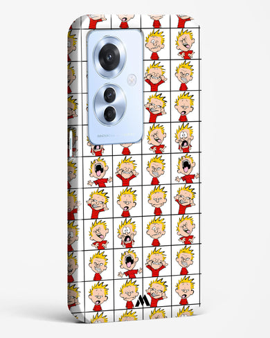 Calvin Making Faces Hard Case Phone Cover (Oppo)