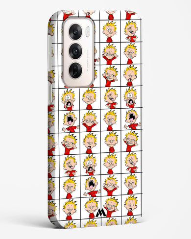 Calvin Making Faces Hard Case Phone Cover (Oppo)