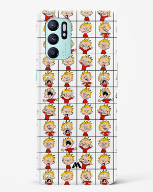 Calvin Making Faces Hard Case Phone Cover (Oppo)