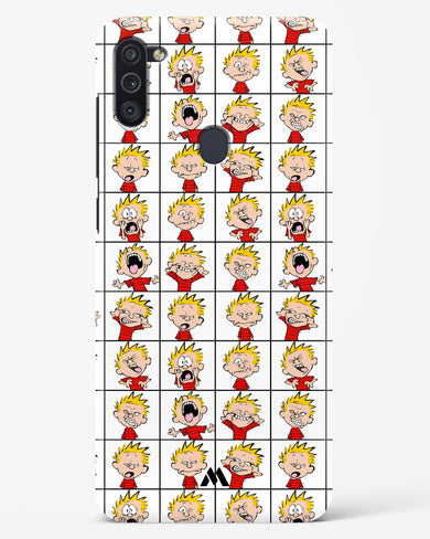 Calvin Making Faces Hard Case Phone Cover (Samsung)