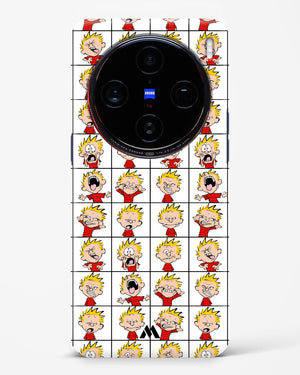 Calvin Making Faces Hard Case Phone Cover (Vivo)