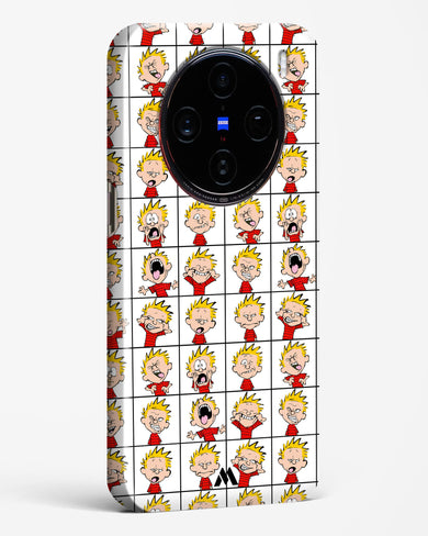 Calvin Making Faces Hard Case Phone Cover (Vivo)