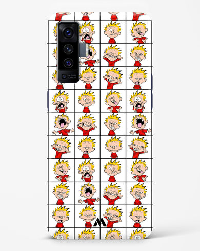 Calvin Making Faces Hard Case Phone Cover (Vivo)