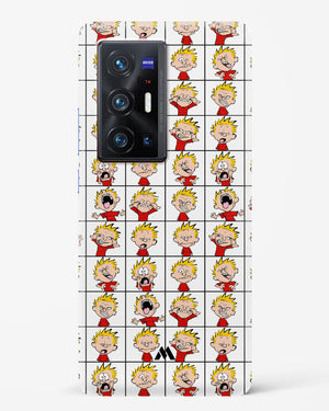 Calvin Making Faces Hard Case Phone Cover (Vivo)