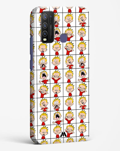 Calvin Making Faces Hard Case Phone Cover (Vivo)