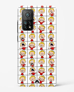 Calvin Making Faces Hard Case Phone Cover (Xiaomi)