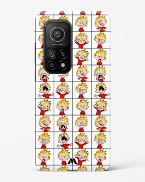 Calvin Making Faces Hard Case Phone Cover (Xiaomi)