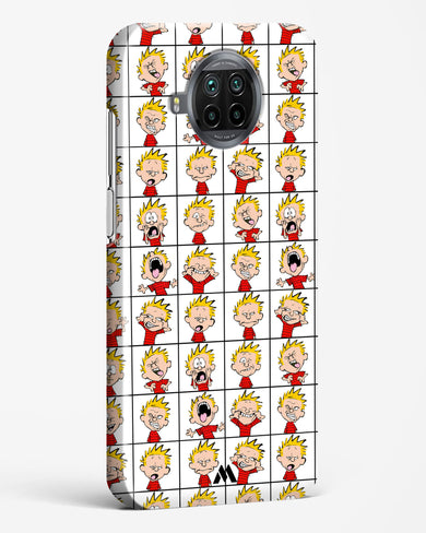 Calvin Making Faces Hard Case Phone Cover (Xiaomi)