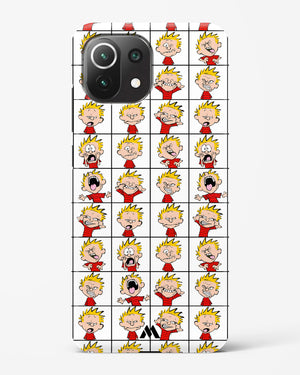 Calvin Making Faces Hard Case Phone Cover (Xiaomi)