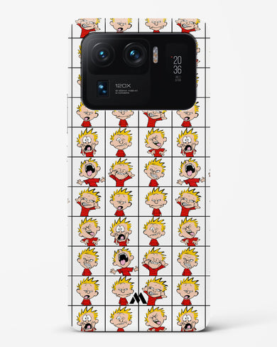 Calvin Making Faces Hard Case Phone Cover-(Xiaomi)