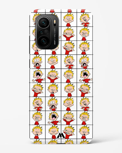Calvin Making Faces Hard Case Phone Cover (Xiaomi)