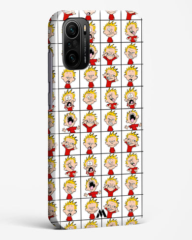 Calvin Making Faces Hard Case Phone Cover-(Xiaomi)