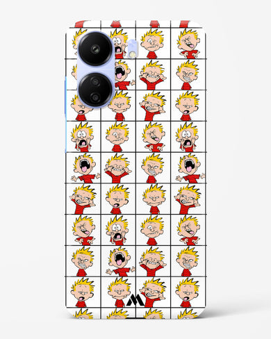 Calvin Making Faces Hard Case Phone Cover (Xiaomi)