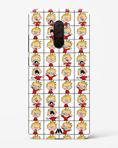 Calvin Making Faces Hard Case Phone Cover (Xiaomi)