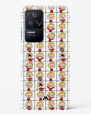 Calvin Making Faces Hard Case Phone Cover-(Xiaomi)