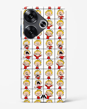 Calvin Making Faces Hard Case Phone Cover (Xiaomi)