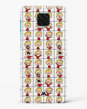 Calvin Making Faces Hard Case Phone Cover (Xiaomi)