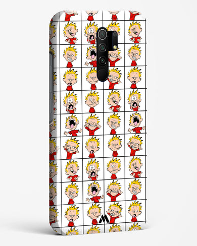 Calvin Making Faces Hard Case Phone Cover-(Xiaomi)