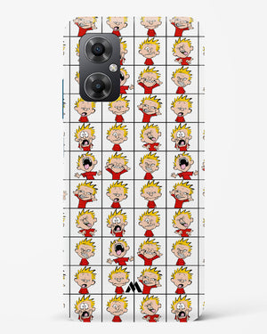 Calvin Making Faces Hard Case Phone Cover (Xiaomi)