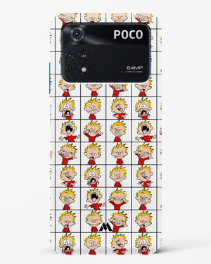 Calvin Making Faces Hard Case Phone Cover (Xiaomi)