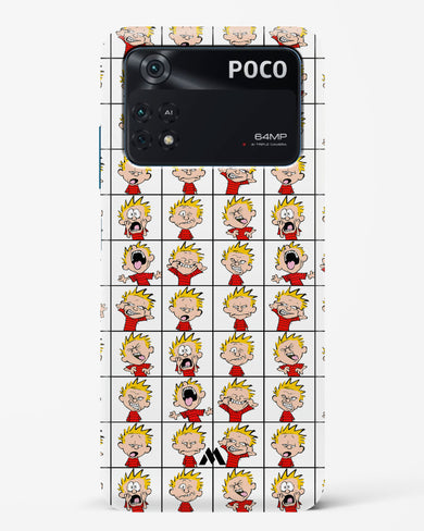 Calvin Making Faces Hard Case Phone Cover (Xiaomi)