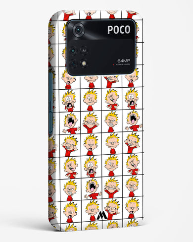 Calvin Making Faces Hard Case Phone Cover (Xiaomi)