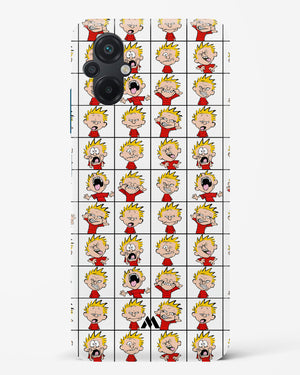Calvin Making Faces Hard Case Phone Cover (Xiaomi)