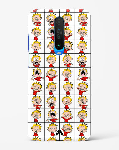 Calvin Making Faces Hard Case Phone Cover (Xiaomi)
