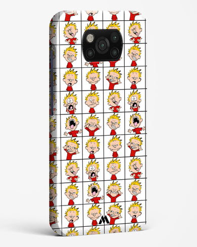 Calvin Making Faces Hard Case Phone Cover-(Xiaomi)