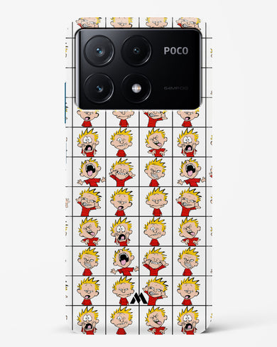 Calvin Making Faces Hard Case Phone Cover (Xiaomi)