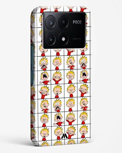 Calvin Making Faces Hard Case Phone Cover (Xiaomi)