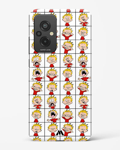 Calvin Making Faces Hard Case Phone Cover (Xiaomi)