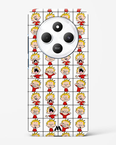 Calvin Making Faces Hard Case Phone Cover (Xiaomi)
