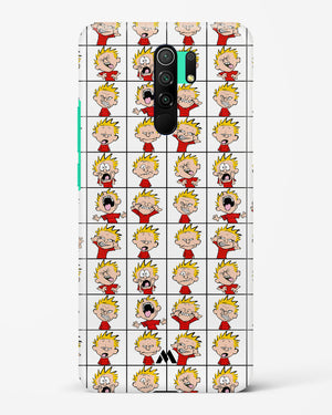 Calvin Making Faces Hard Case Phone Cover (Xiaomi)