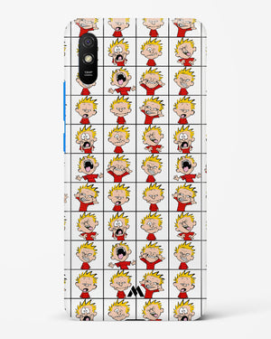 Calvin Making Faces Hard Case Phone Cover (Xiaomi)