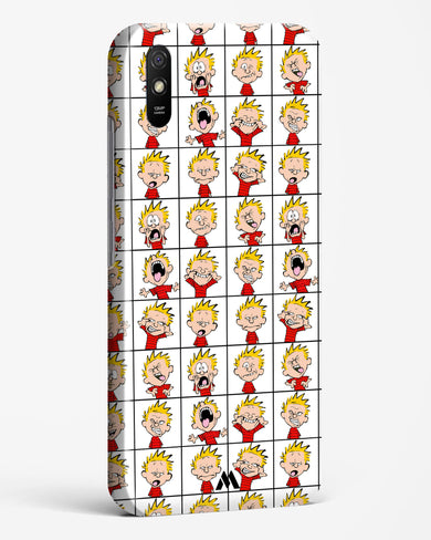 Calvin Making Faces Hard Case Phone Cover (Xiaomi)