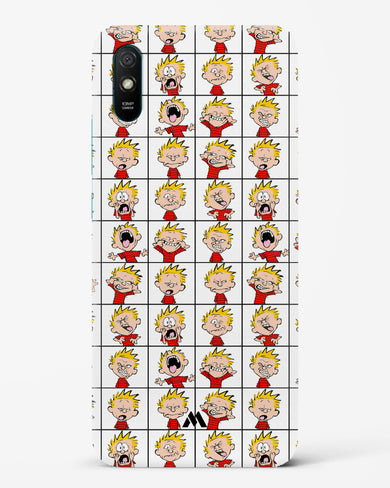 Calvin Making Faces Hard Case Phone Cover-(Xiaomi)