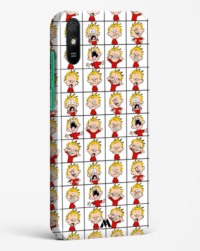 Calvin Making Faces Hard Case Phone Cover-(Xiaomi)