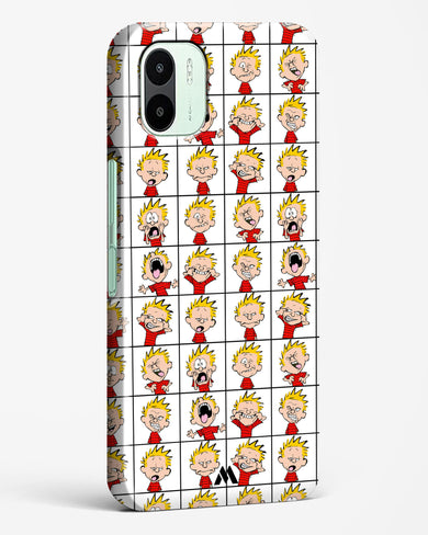 Calvin Making Faces Hard Case Phone Cover (Xiaomi)