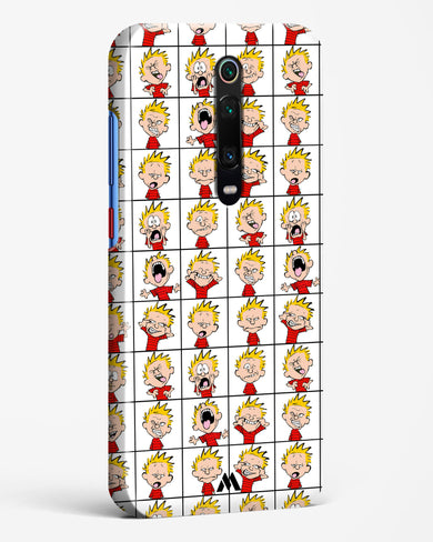 Calvin Making Faces Hard Case Phone Cover (Xiaomi)