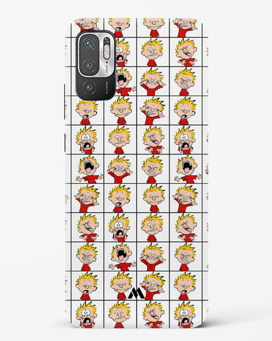 Calvin Making Faces Hard Case Phone Cover-(Xiaomi)