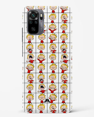 Calvin Making Faces Hard Case Phone Cover (Xiaomi)