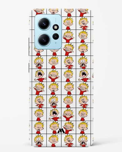 Calvin Making Faces Hard Case Phone Cover (Xiaomi)