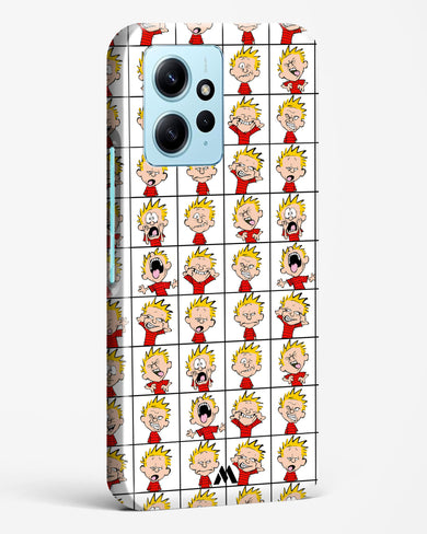 Calvin Making Faces Hard Case Phone Cover (Xiaomi)