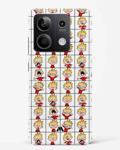 Calvin Making Faces Hard Case Phone Cover (Xiaomi)