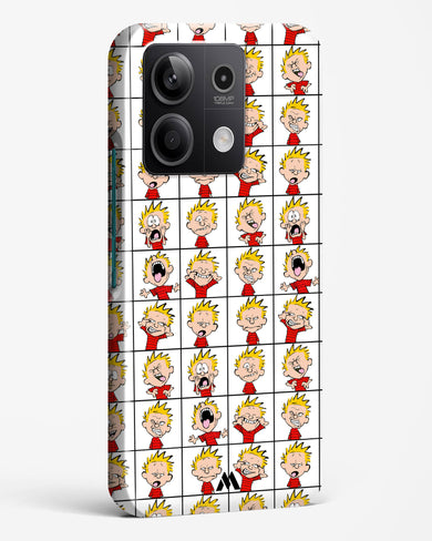 Calvin Making Faces Hard Case Phone Cover (Xiaomi)