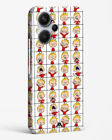 Calvin Making Faces Hard Case Phone Cover (Xiaomi)