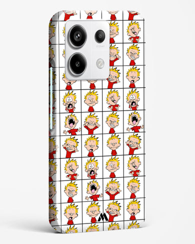 Calvin Making Faces Hard Case Phone Cover (Xiaomi)