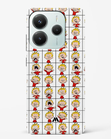Calvin Making Faces Hard Case Phone Cover (Xiaomi)