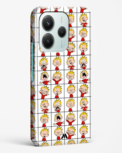 Calvin Making Faces Hard Case Phone Cover (Xiaomi)